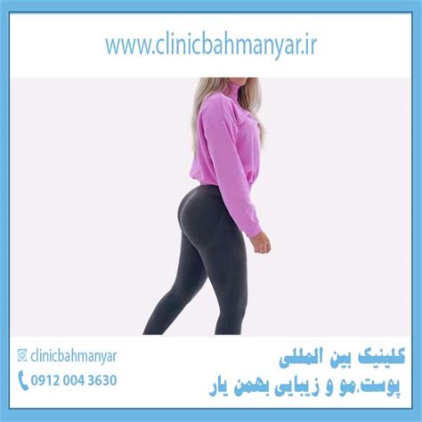 چگونه شکم تخت باسن خوش فرم و بزرگ و کمر باریک داشته باشیم کلینیک