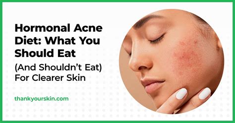 Hormonal Acne Diet What You Should Eat And Shouldnt Eat For Clearer