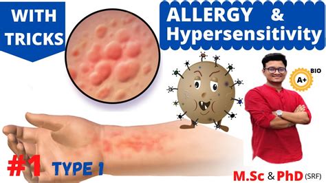 Allergy And Hypersensitivity Type I Youtube