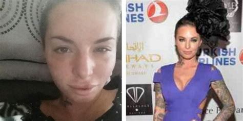 Christy Mack Shares Recovery Photos After Alleged Assault By Mma