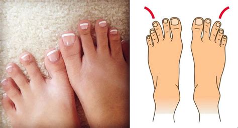 9 Formes De Pieds Qui Révèlent Des Secrets Sur Votre Personnalité