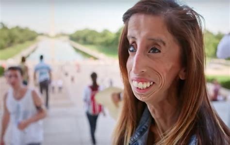 She Was Once Called The Worlds Ugliest Woman—now Shes Living Your Dreams