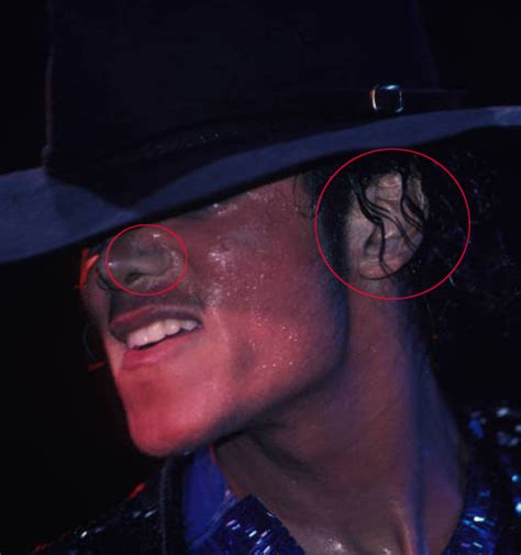The Vitiligo Proof Michael Jackson Photo 32272018 Fanpop