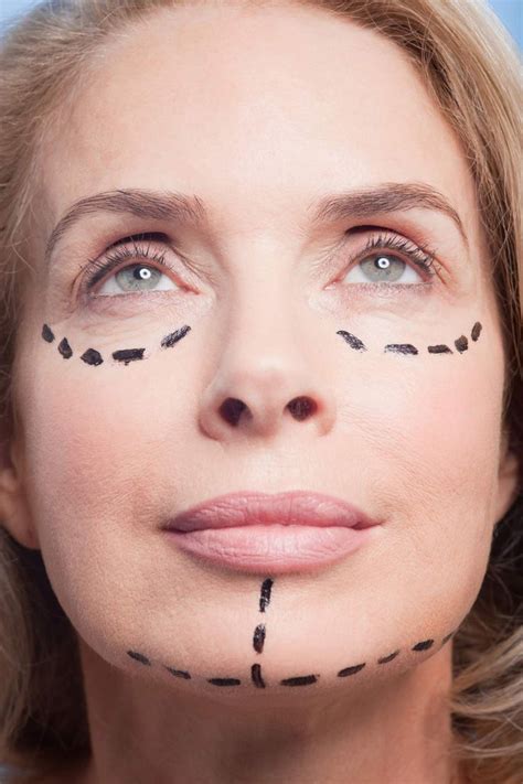 Can Plastic Surgery Make You More Likeable A Close Look At A New Study