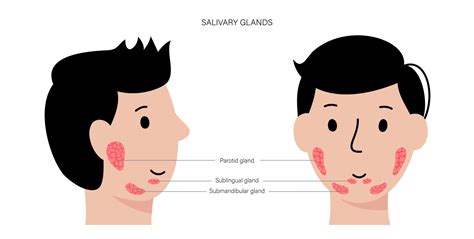 Salivary Gland Disorders Causes And Symptoms Birla Hospital