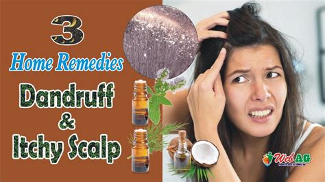 3 Home Remedies For Dandruff And Itchy Scalp Webag