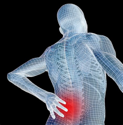 Mechanical Back Pain Sprains Strains