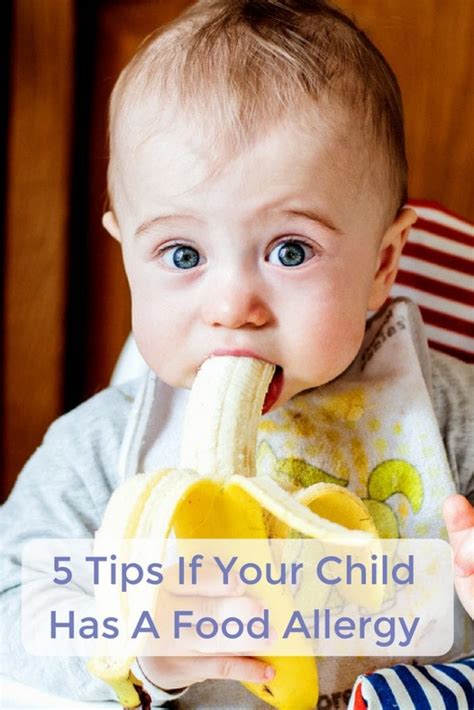 5 Tips If Your Child Has A Food Allergy Twiniversity