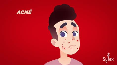 A Man With Acne On His Face And The Word Sulex Above Him Reads Acne