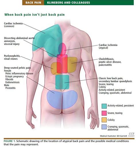 Shoulder Pain Diagram Diagnosis Chart Shoulder Pain Exp