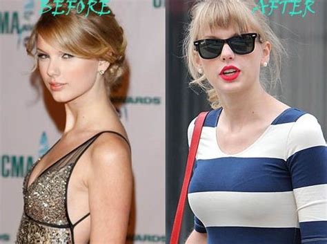 Taylor Swift Before And After Breast Augmentation 01 Celebrity