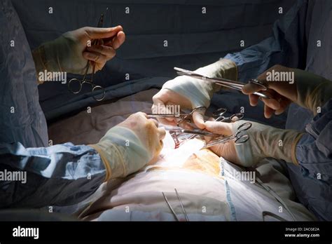 Hernia Operation Surgeons Performing Surgery To Repair An Epigastric
