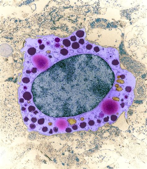 Mast Cell Stock Image P2660071 Science Photo Library