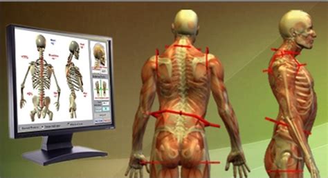Analysis Of Postural Assessment Methods And Virtual Simulation Tools My Xxx Hot Girl