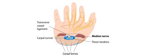 Upper Limb Nerve Lesions Part 2 The Radial Nerve Medi
