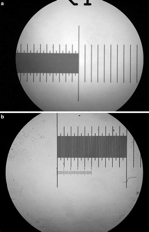 7 Calibration Of Field Diameter A And Ocular Micrometer Scale B