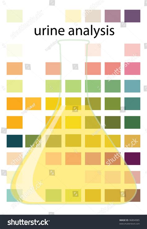 Urine Analysis Test Colors Glass Container Stock Vector Royalty Free