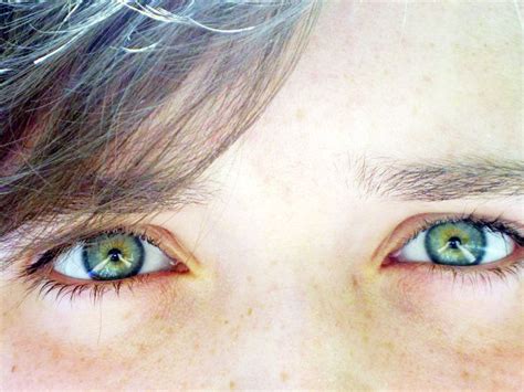 Central Heterochromia Eye Color Heterochromia