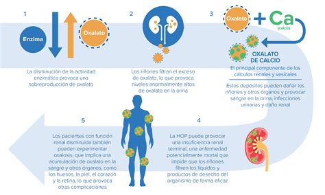 Helpful Information About Primary Hyperoxaluria Dicerna Pharmaceuticals