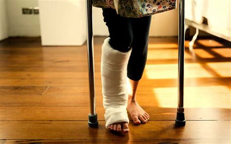 Exercises To Help Your Child After Their Leg Fracture Auckland
