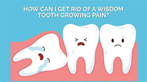 How To Deal With Wisdom Tooth Pain 3 Ways Easy Peasy