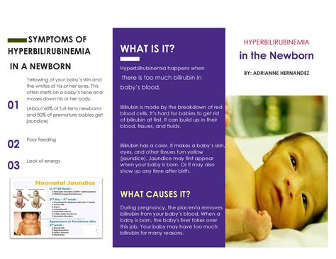 Hyperbilirubinemia Brochure 6 Symptoms Of Hyperbilirubinemia In A