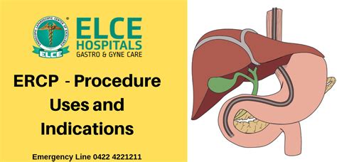 Ercp Procedure Uses And Indications Elce Clinic Coimbatore
