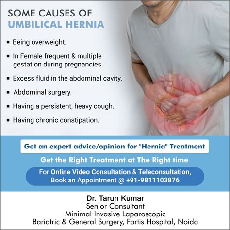 Dr Tarun Kumar Surgeon Some Causes Of Umbilical Hernia