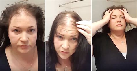 Woman With Thin Hair Does Tutorial To Camouflage It
