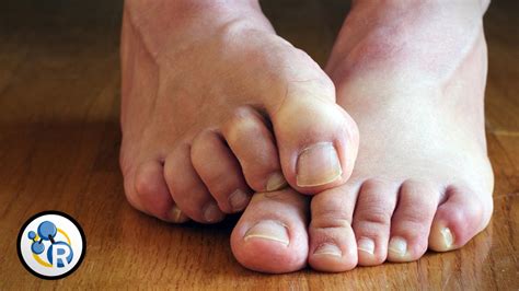 Why Do Feet Stink Video Eurekalert Science News
