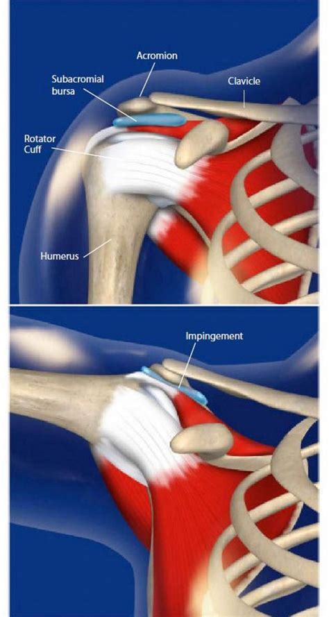 Shoulder Ligament Anatomy Diagram Shoulder Impingemen
