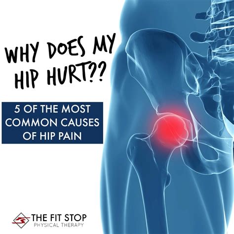 Most Common Causes Of Hip Pain Fit Stop Physical Therapy