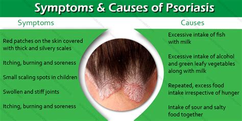Top 7 Proven Natural Remedies To Treat Psoriasis Articlecube