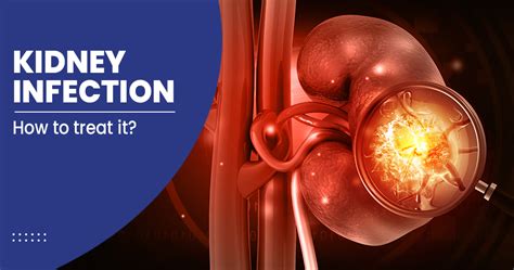 Kidney Infection Symptoms Treatments Preventions