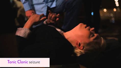 The Importance Of Tonic Clonic Seizure Video In Understanding Epilepsy Martlabpro