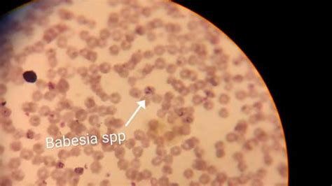 Diagnosis And Therapeutic Management Of Babesiosis In Cattle Epashupalan