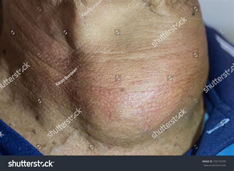 Zooming Closeup Frontal Anterior View Enlarged Stock Photo 734170705