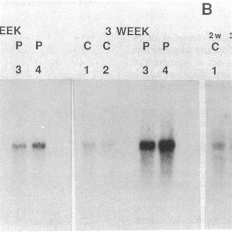Elevated Expression Of C Myc Mrna In Arpkd A Samples 5 Jug Of