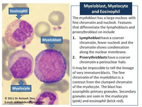 The Earliest Morphologically Distinct Myeloid Cell Is A Myeloblast