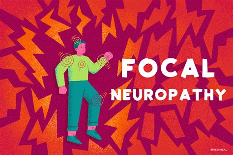 Focal Neuropathy Veriheal
