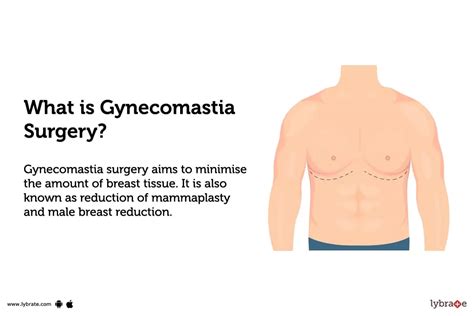 Gynecomastia Surgery Purpose Procedure Benefits And Side Effects