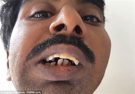 malnourished indian man eats solid food for the first time daily mail online