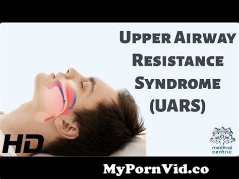 What Is Upper Airway Resistance Syndrome Ask Dr Olmos From Uars
