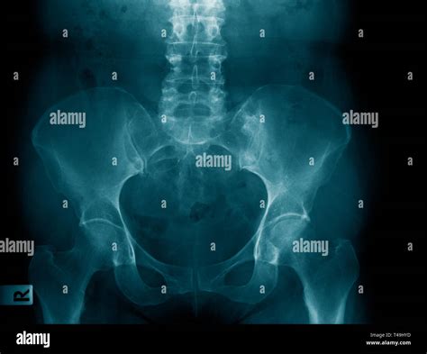 Pelvic Exam Hi Res Stock Photography And Images Alamy