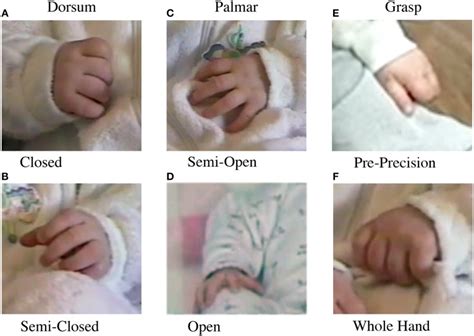 Ways To Think About The Development Of Hand Function Task Oriented