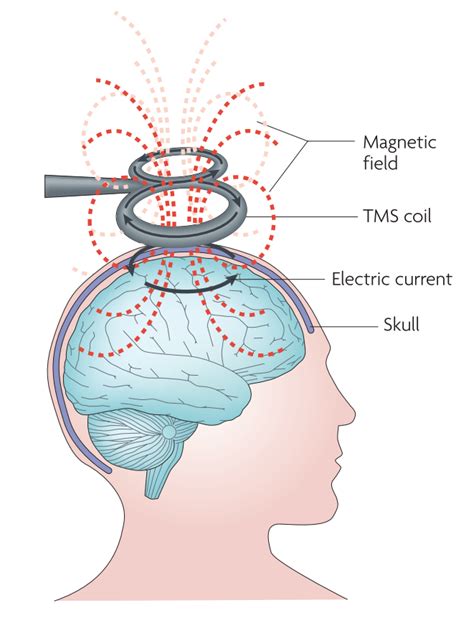Transcranial Magnetic Stimulation Hce Wiki The Human