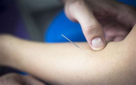 Top Benefits Of Acupuncture For Your Body