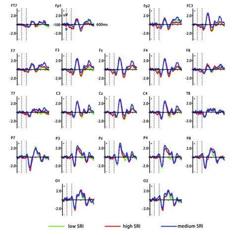 Grand Averaged Event Related Potentials Erps Waveforms Elicited By