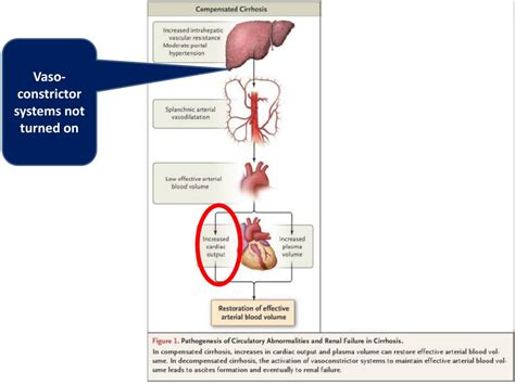 Ppt Ascites In The Chronic Renal Failure Patient With Cirrhosis
