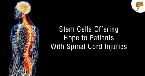 Stem Cells Offering Hope To Patients With Spinal Cord